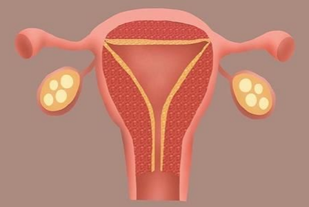 子宮內(nèi)膜薄總懷不上？