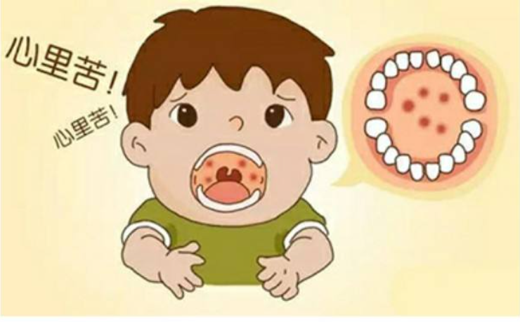 夏季高發(fā)的這種病不是口腔潰瘍！